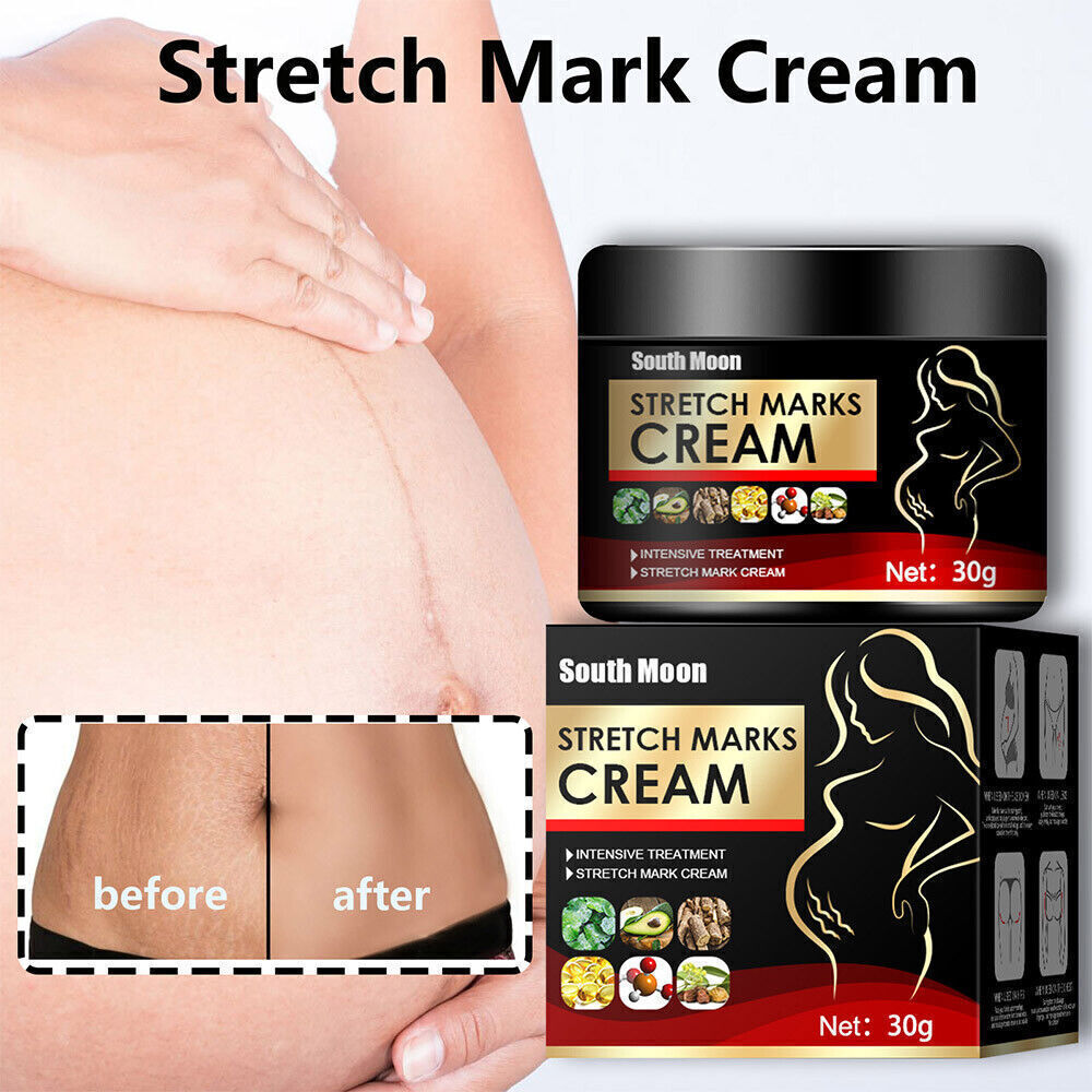 UK Pregnancy Scar, Spots Acne Scar, Stretch Marks Removal Cream Clarifying Skin