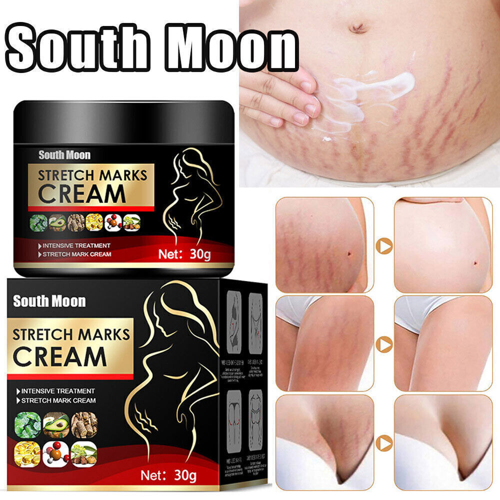 UK Pregnancy Scar, Spots Acne Scar, Stretch Marks Removal Cream Clarifying Skin