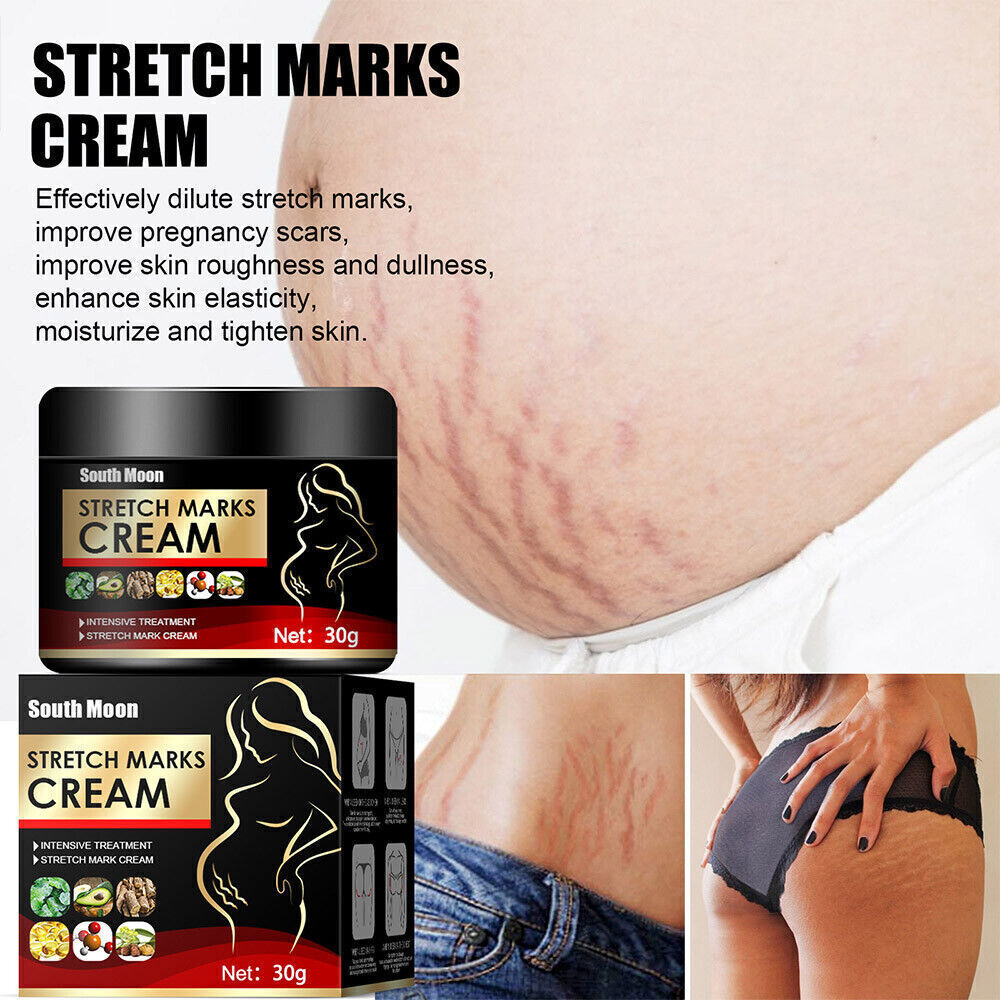 UK Pregnancy Scar, Spots Acne Scar, Stretch Marks Removal Cream Clarifying Skin