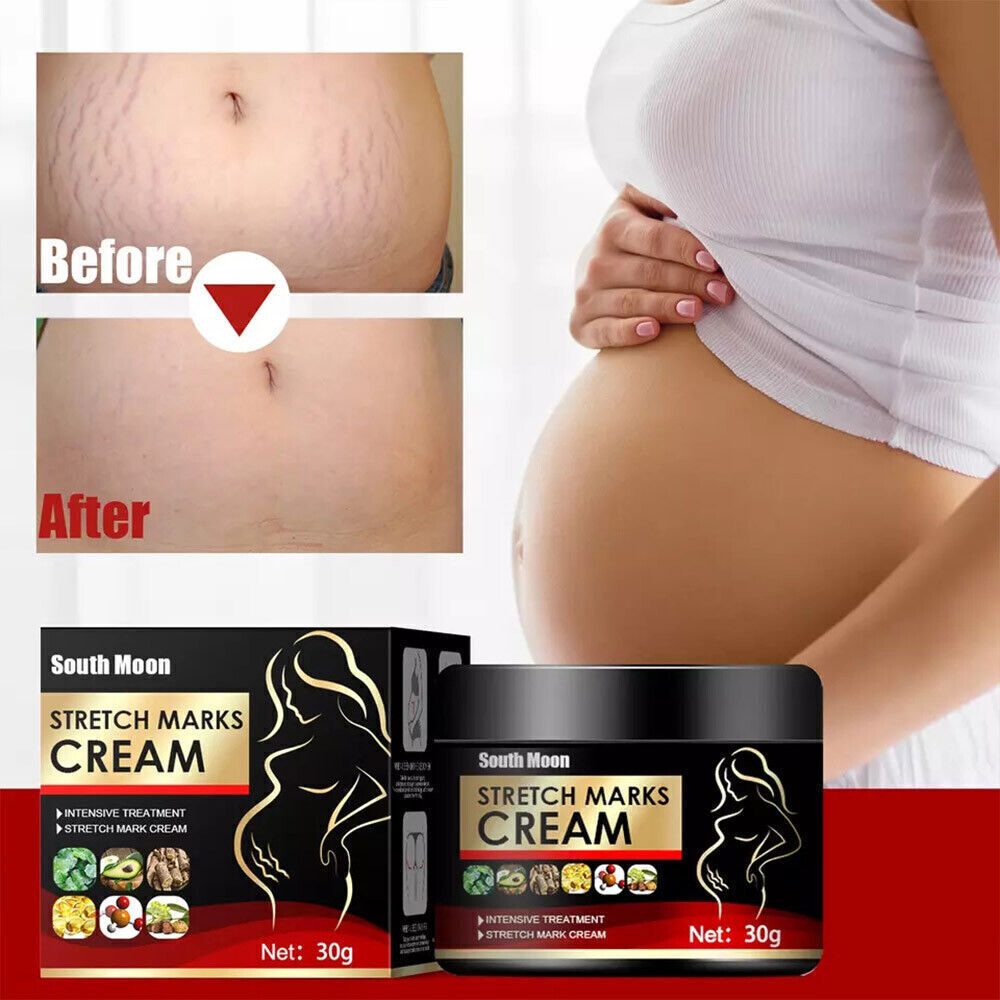 UK Pregnancy Scar, Spots Acne Scar, Stretch Marks Removal Cream Clarifying Skin