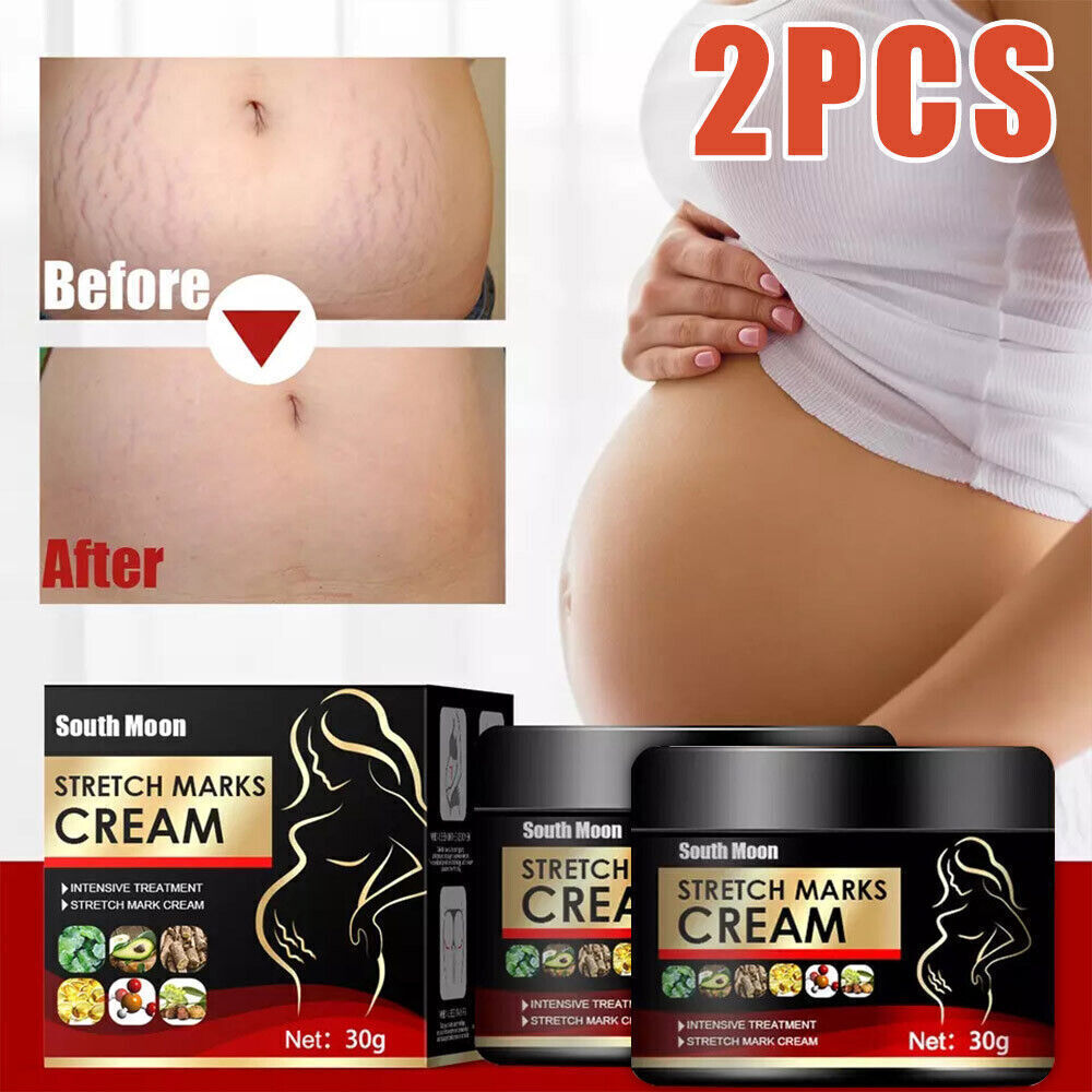 UK Pregnancy Scar, Spots Acne Scar, Stretch Marks Removal Cream Clarifying Skin