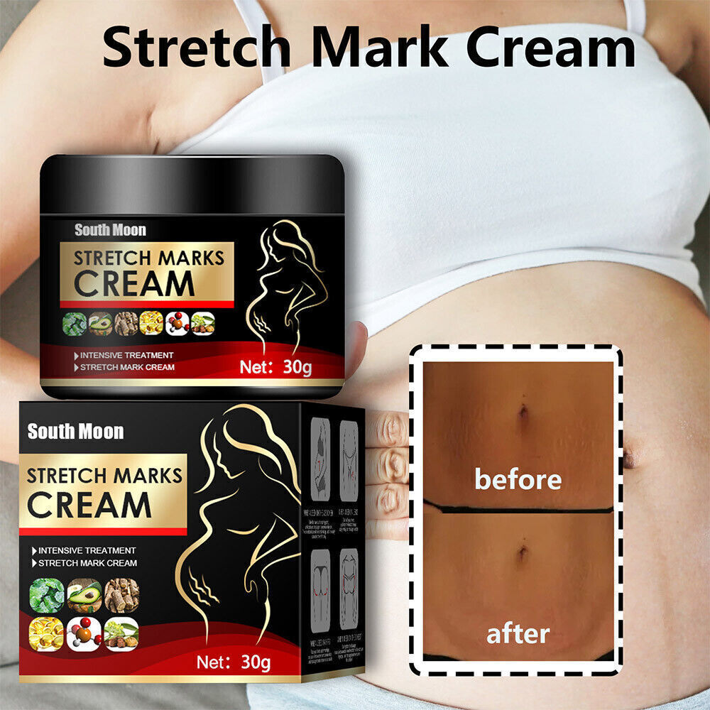 UK Pregnancy Scar, Spots Acne Scar, Stretch Marks Removal Cream Clarifying Skin
