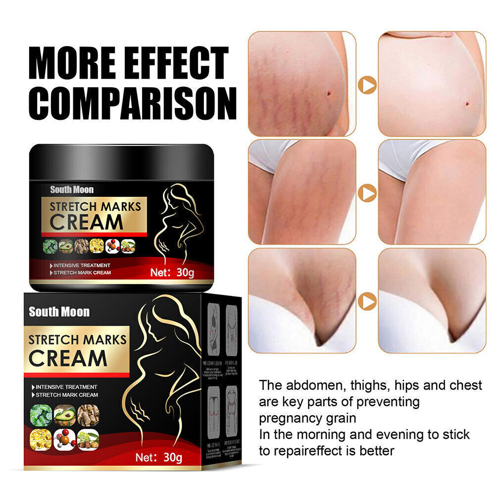 UK Pregnancy Scar, Spots Acne Scar, Stretch Marks Removal Cream Clarifying Skin